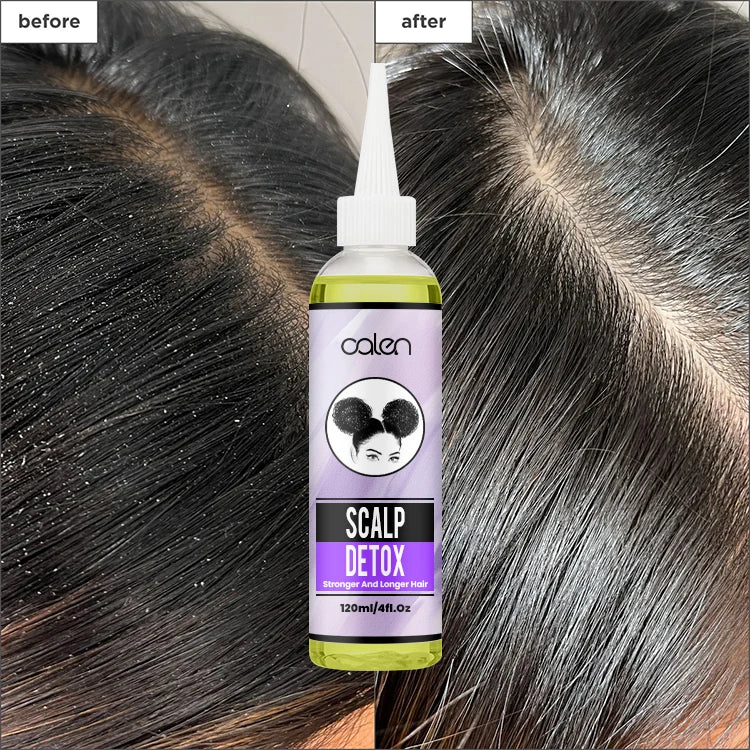 Oalen Private Label 120Ml Biotin Anti Hair Loss Treatment Scalp Detox Hair Growth Oil