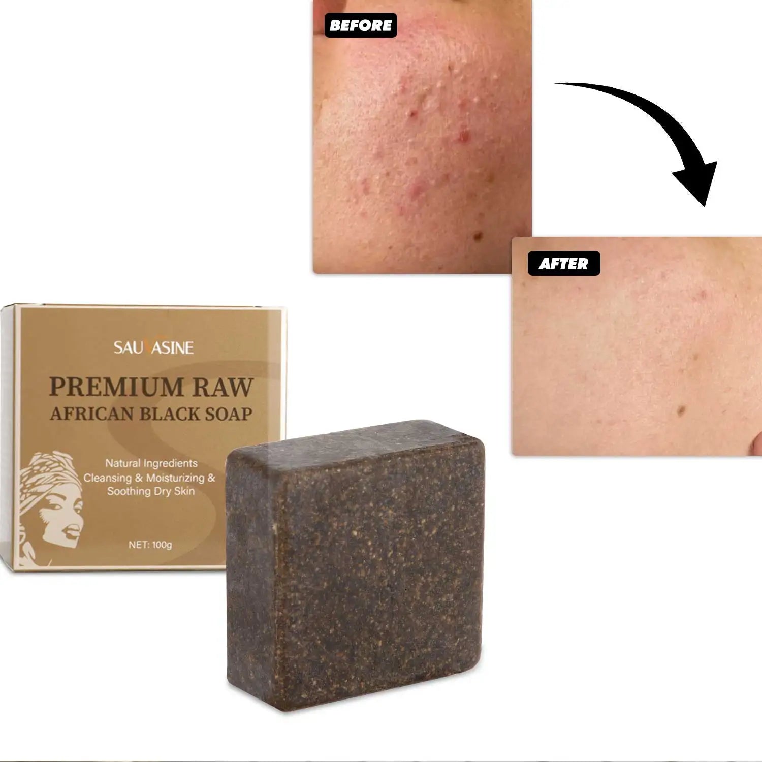 Lanthome Wholesale Nourishing Cleansing Soothing Dry Skin Premium Raw African Black Soap African Black Soap