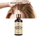 Private Label Hair Growth Serum Hair Care Loss Growth Serum Fast Effective Biotin Hair Growth Serum