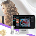 Portable Trichoscopy Hair Analysis Machine AI Intelligent Hair Scalp Analysis Anti-Hair Loss Treatment Device with Report MegaBDM