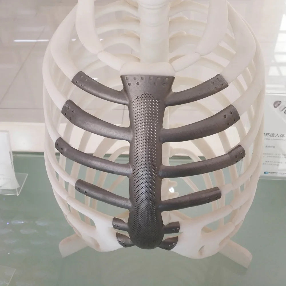 Titanium 3D Printing | 3D Printing Technology