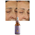 Oalen 30ml Private Label Moisturizing and Hydrating Serum Vitamin C Serum