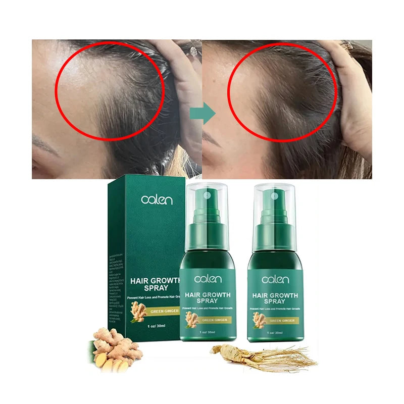 Oalen Dropshipping Private Label Hair Loss Treatment Green Ginger Hair Growth Spray