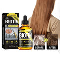 Biotin with Hydrolyzed Collagen Powder Supplement (B7 Vitamin) Supplement Hair & Skin Support Super Absorption (30mL/1 Fl Oz)
