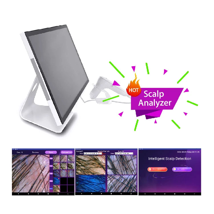 AI Hair Analyzer Machine with 50X/200X HD Scalp Scanner for Follicle Detection & Scalp Health Analysis