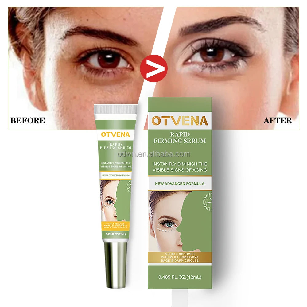 OTVENA 60 Seconds Remove Wrinkle Eye Bag Dark CIrcle Rapid Friming Skin Instant Eye Cream