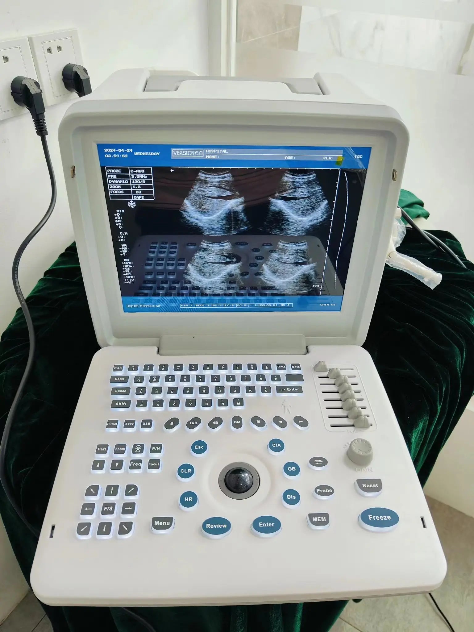 Rayman Portable Vet Ultrasound Portable Veterinary Ultrasound Machine Animal Ultrasound Scanner Price