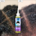 Oalen OEM 120Ml Detox Refreshing Anti Itch Scalp Repair Psoriasis Cleansing Used Before Shampoo