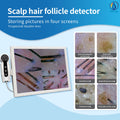 High Precision Desktop Hair Scalp Scanner Analyzer for Detecting Dandruff Hair Thinning and Skin Wrinkles for Professional Use