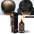 OTVENA Fast Growth Hair Oil 100% Effective Strong Roots Healthy Hair Herbal Fumula Anti Hair Loss Oil Hair Care