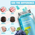 OEM ODM Factory Price Collagen Gummies Free Sample Collagen Gummies Candy Gummy for Skin Whitening