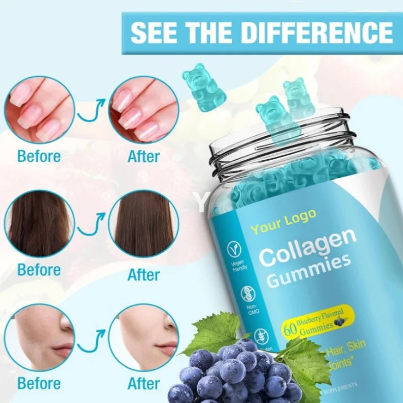 OEM ODM Factory Price Collagen Gummies Free Sample Collagen Gummies Candy Gummy for Skin Whitening