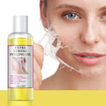 Eternalelinor Customized Yellow Peeling Oil Anti Aging and Anti Stretch Mark Lotion for Face Wholesale Peeling Oil extra Strong
