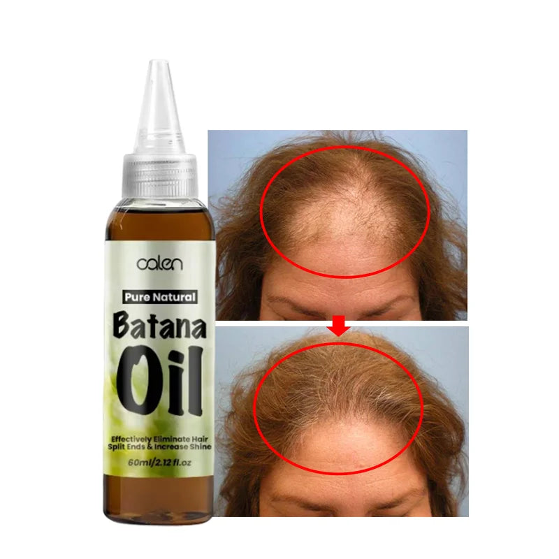 60ML Wholesale ODM Batana Hair Oil Enhances Hair and Skin Radiance Organic Natural Batana Oil for Hair