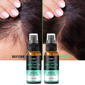 Private Label Improve Hair Growth Anti-Loss and Regrowth Instant Herbal Hair Growth Spray