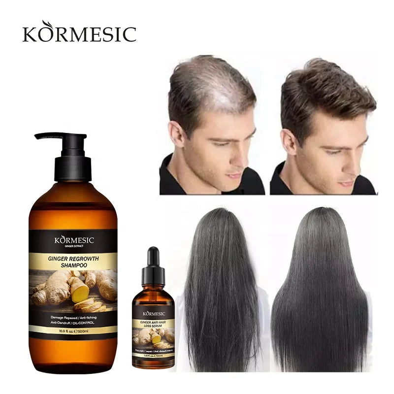 OEM ODM Private Label Ginger Without Silicone Oil Nourishing Scalp Care Anti-Itching Shampoo