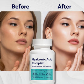 Hyaluronic Acid Complex Capsules with Vitamins Marine Collagen Peptides Skin Health Joint Wellness Private Label Manufacturer