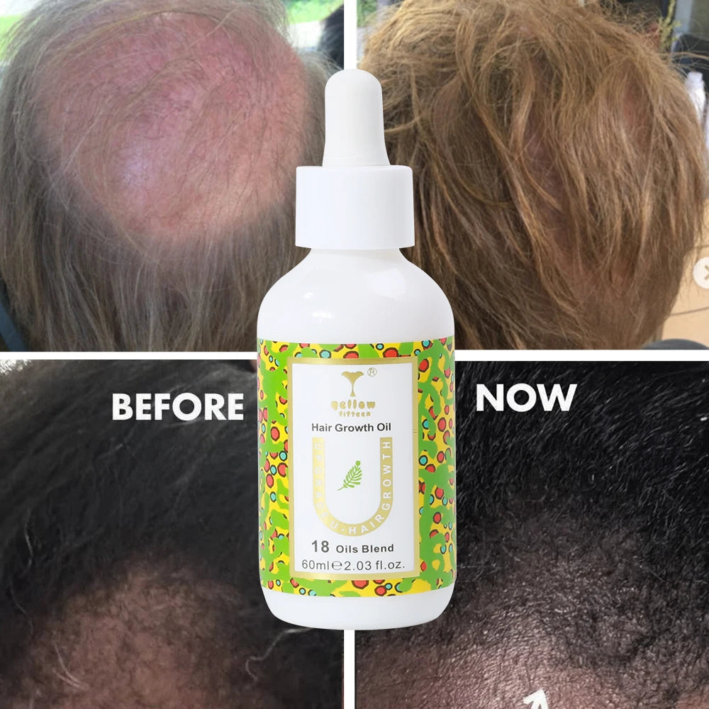 Hair Repairing Anti-Hair Loss Nourishing Rosemary Peppermint Hair Growth Oil Hyaluronic Acid Leave-In Formula 60ml-Thickening