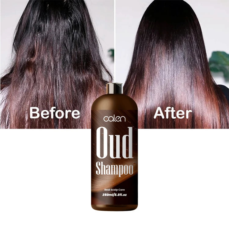 Oalen Custom Logo Vegan 250ml Anti-Dandruff Repair & Nourish Shampoo with Hyaluronic Acid Oud