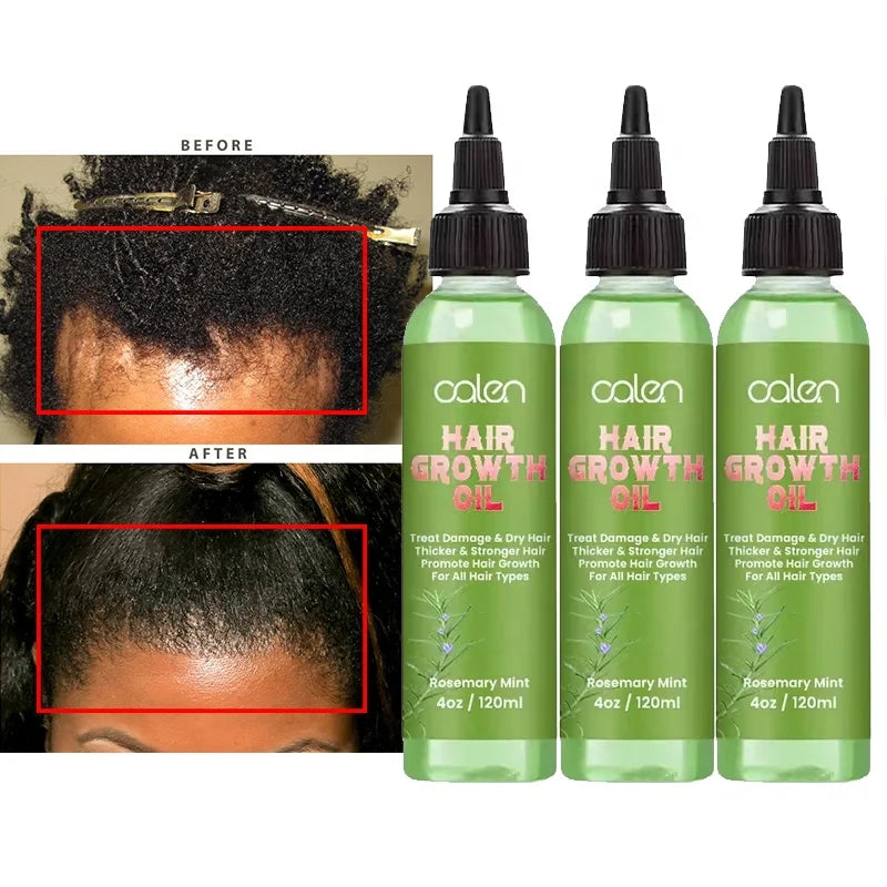 Oalen Organic Hair Care Oil with Argan Herbal Ingredients Mint Refreshing Scalp Oil for Hair Growth Nourishing Tension Relief