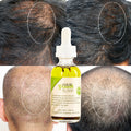 Private Label 100% Natural Herbal Hair Growth Oil Scalp Strengthening Rosemary Mint Hair Growth Elixir