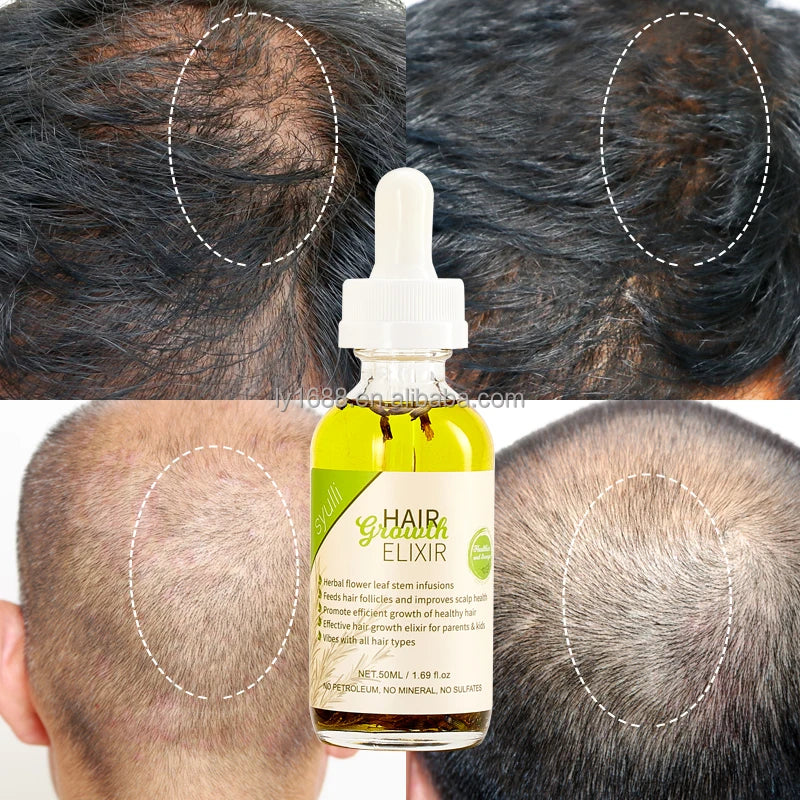 Private Label 100% Natural Herbal Hair Growth Oil Scalp Strengthening Rosemary Mint Hair Growth Elixir