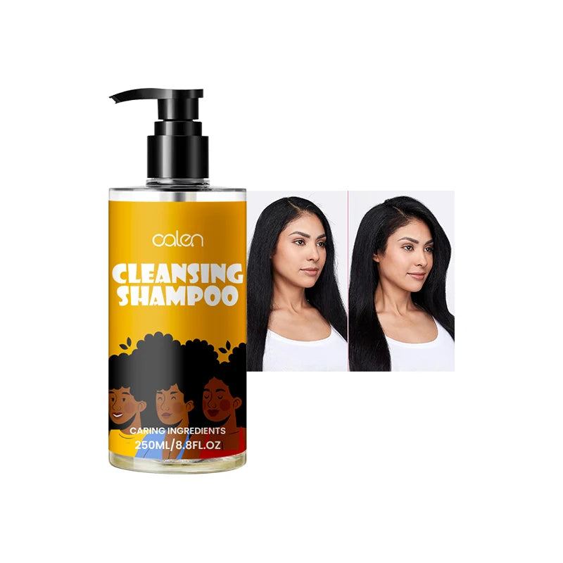 Oalen Custom Logo 250Ml Deep Cleans Refreshes Scalp Best Dry Shampoo for All Hair Types