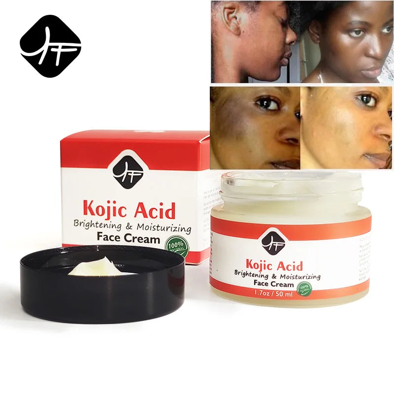 BEST SELLING Moisturizer KOJIC AICD FACE CREAM Spot Removing Moisturizing for Black Skin KOJIC ACID WHITENING SKIN CREAM
