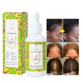 OEM ODM Factory Hair Care Loss Treatment Ginger Argan Rosemary 22 Essential Oil Biotin Hair Growth Anti Hair Loss Serum
