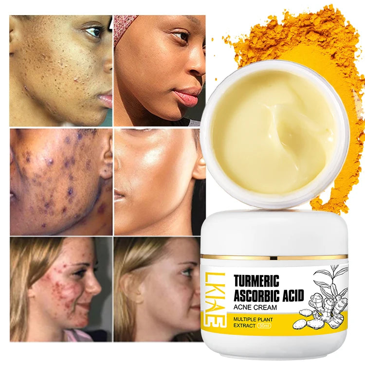 Black Skin Whitening Anti-Acne Spot Beauty Skincare Turmeric Niacinamide Vitamin C Brightening Glow 50ml Face Cream