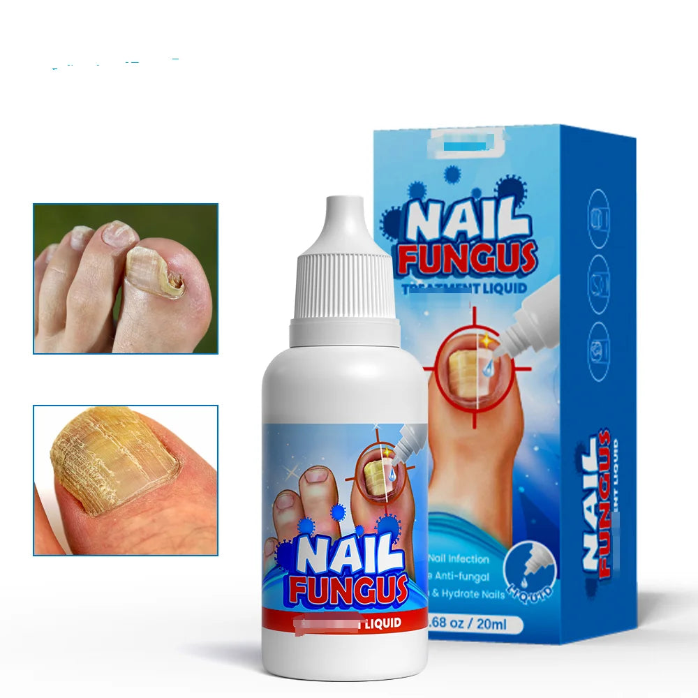 Nail Fungal Serum Onychomycosis Paronychia Anti-Fungal Liquid Nail Infection Toe Fungus Foot Repair Essence 20ml