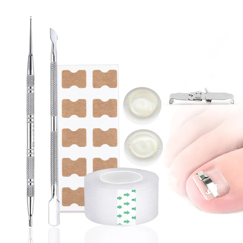 Useful Ingrown Nail Foot Correction Tool Pedicure Toenail Fixer Foot Nail Care Tool Orthotic Nail Corrector Pedicure Tool