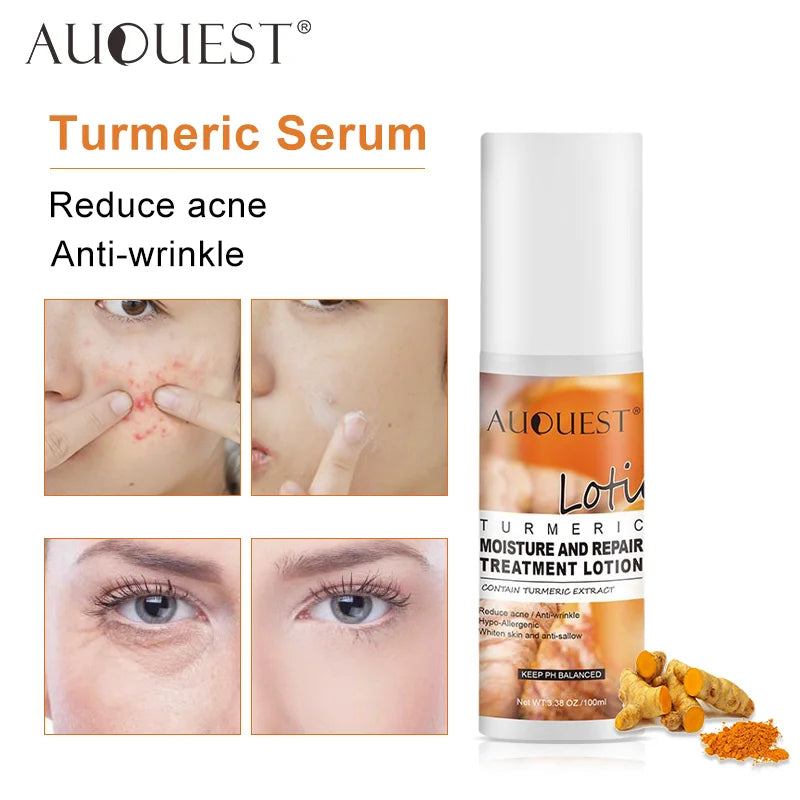 Wholesale Skin Care Turmeric Serum Private Label Whitening Remove Acne Dark Spot Removeer Vitamin C Turmeric Face Serum