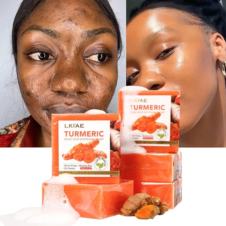Wholesale Acne Treatments Organic Shower Skin Care Lemon Whitening Lightening Brightening Turmeric Kojic Acid Soap