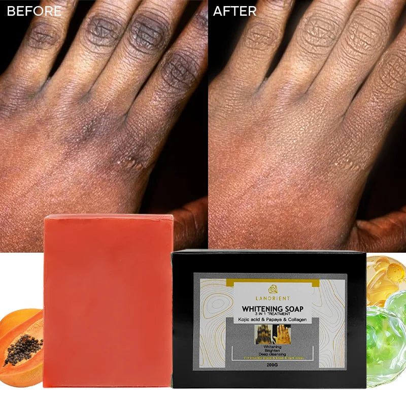 OEM Custom Logo Organic Vitamin C Skin Whitening and Exfoliating Handmade Soap Knuckle Whitening Kojic Acid Soap for Dark Skin MegaBDM