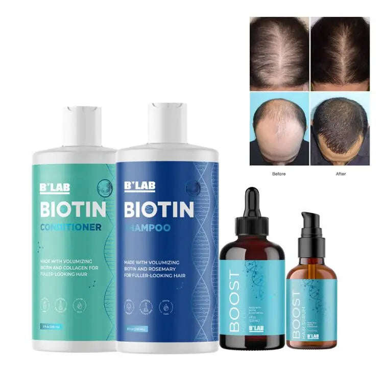 Hair Growth Shampoo OEM Customized Logo Natural Anti- Hair Loss Thickening Biotin Hair Shampoo Set for Daily Care