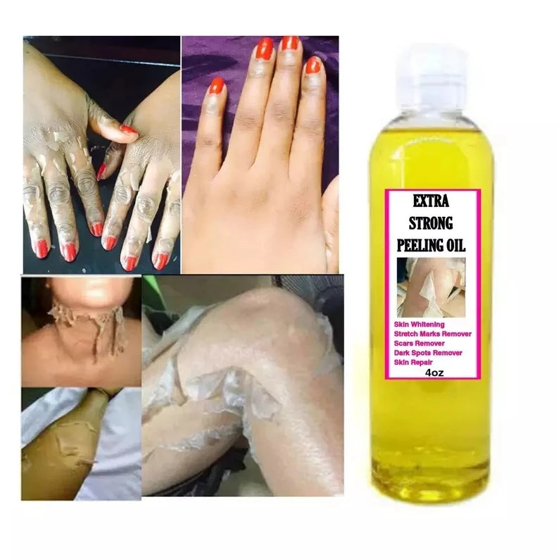 AiXin Custom Private Label Removing Dead Skin Dark Knuckles Brightening Exfoliate Extra Strong Yellow Peeling Oil Skin Whitening