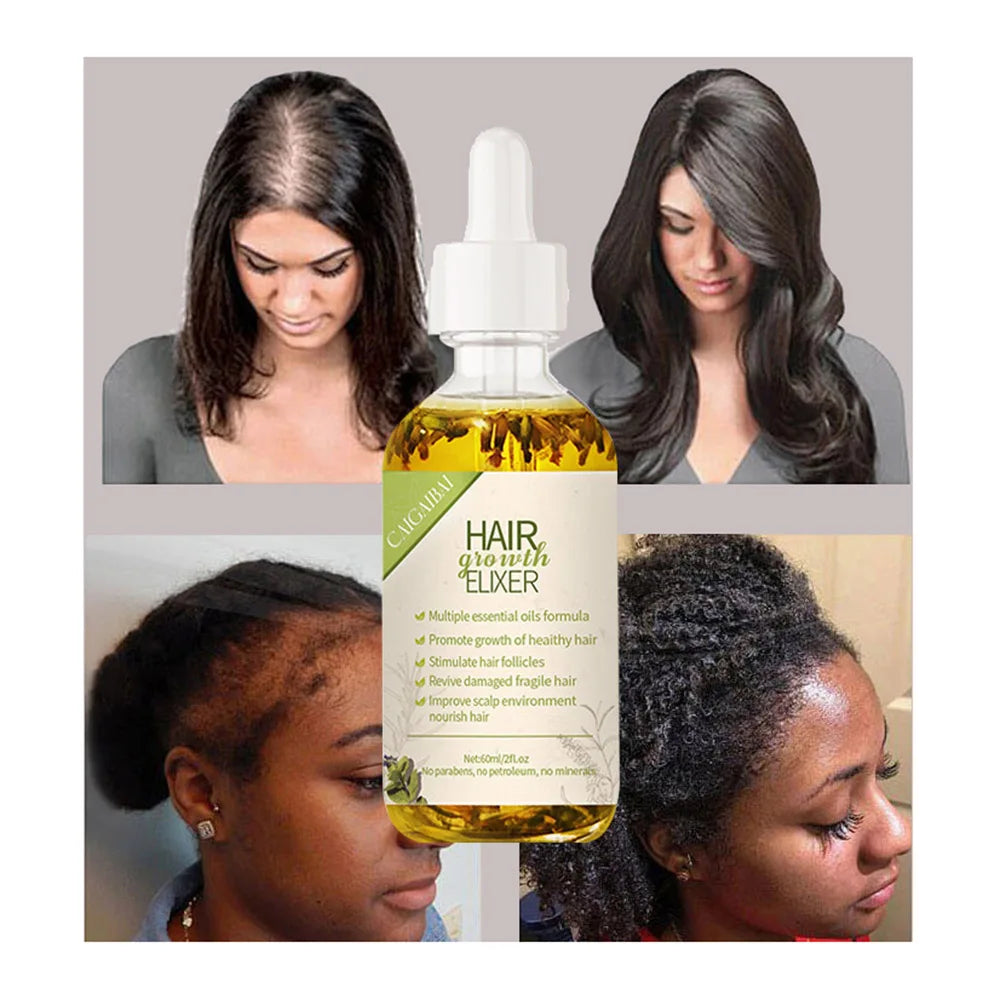 Private Label 100% Natural Organic Rosemary Castor Almond Oil Men Women Scalp Care Serum Hair Treatment Growth Oil MegaBDM