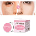 Strong Removal Melasma Whitening Cream Freckle Speckle Sunburn Spots Melanin Removal Whitening Face Cream