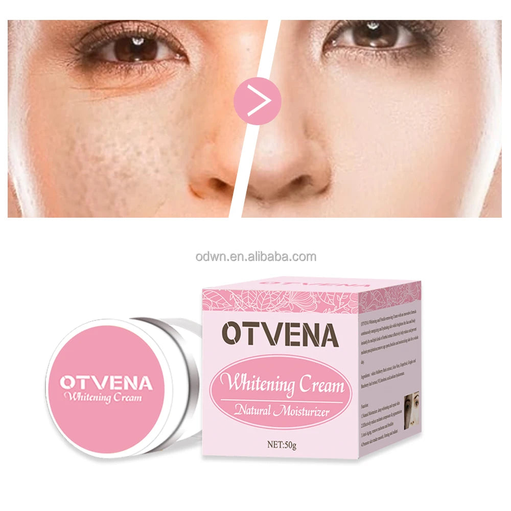 Strong Removal Melasma Whitening Cream Freckle Speckle Sunburn Spots Melanin Removal Whitening Face Cream