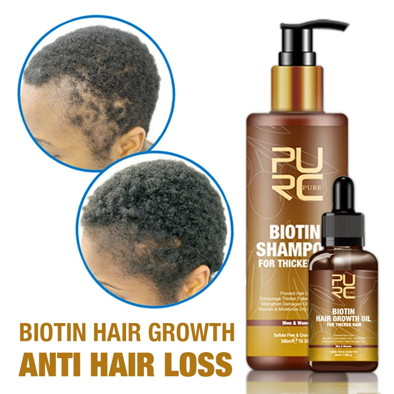 Customize Natural Hair Growth Serum Organic Fast Hair Growth Oil for Black Women Private Label