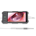 Digital Otoscope Video Ear Cleaner 3.9mm/4.5mm Pick 5inch Screen Ear Wax Removal Tool Visual Ear Wax Screen Clean Tool