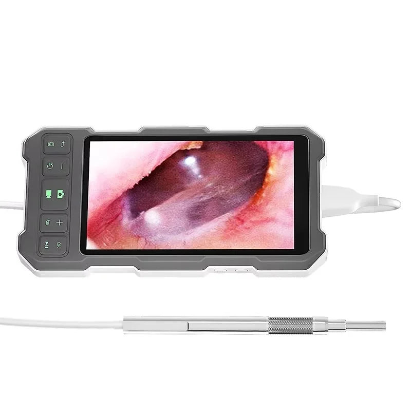 Digital Otoscope Video Ear Cleaner 3.9mm/4.5mm Pick 5inch Screen Ear Wax Removal Tool Visual Ear Wax Screen Clean Tool