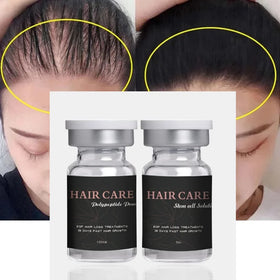 Customized logo Natural Anti Hair Loss Serum Prevent Hair Loss Fast Grows Nourish Damaged Fall Hair Growth Serum G