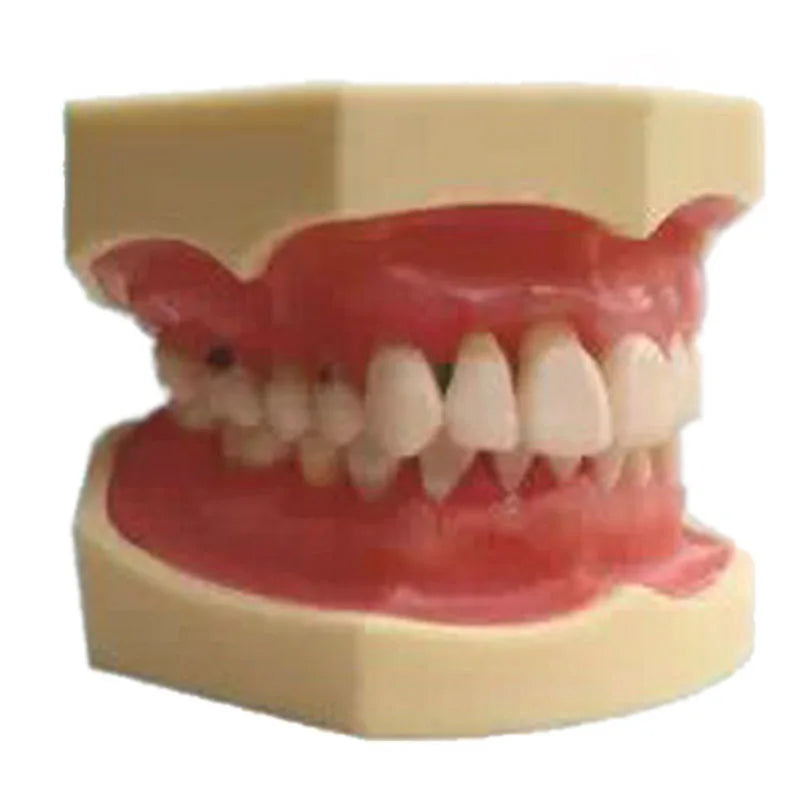 Medical Science Dental Periodontal Disease Pathology Teeth Model for Medical Teaching