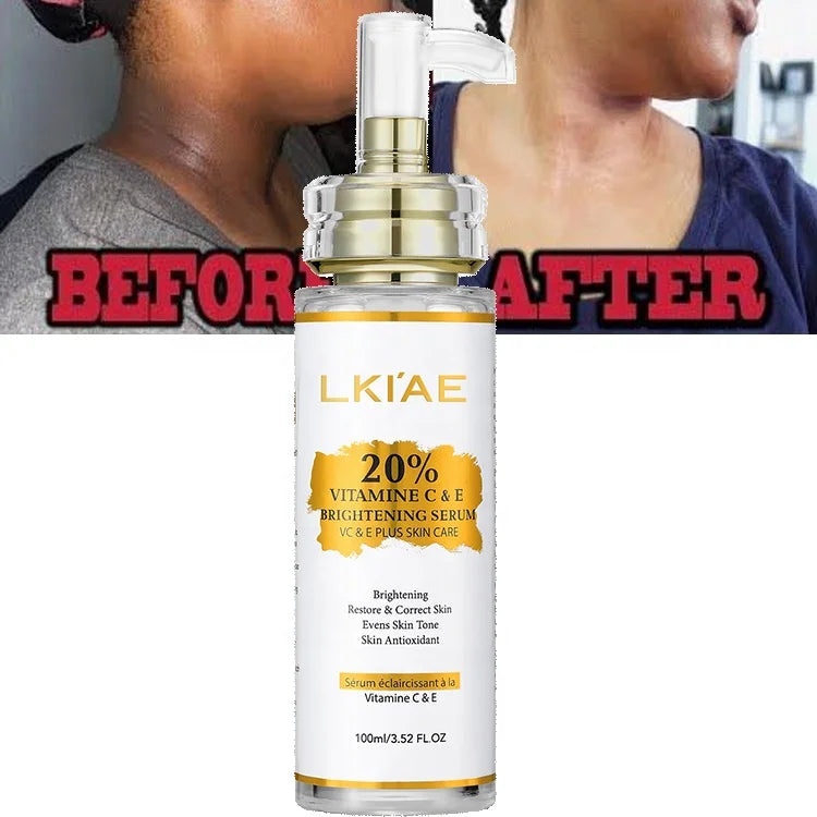 Vegan 20% Vitamin C Organic Natural Super Brightening Hydra Face and Neck Colagen Whitening Serum for Black Skin