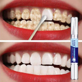 CAILIKOU Portable Tooth Bleaching Gel Teeth Whitening Bright Gel Pen