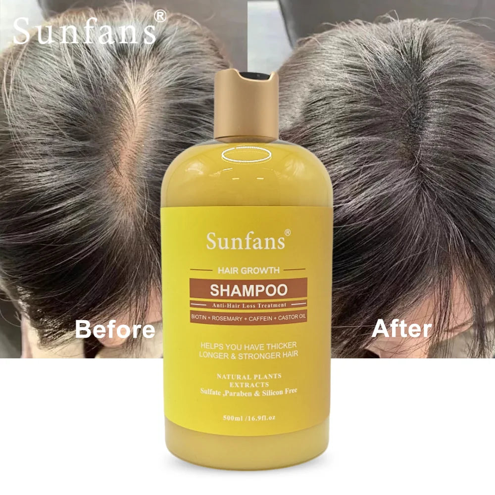 Organic Natural Herbal Liquid Hair Shampoo Set with Rosemary & Castor Oil for Hair Growth & Anti-Hair Loss Unisex All Ages