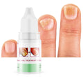 2025 Nail Care Supply Kit Fungal Nail Prevention and Conditioning Natural Nail Gel