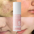 Wholesale 5 in 1 Line Hydrating Facial Spray Mist Toner Deep Moisturizing Sensitive Acne Remover Niacinamide Face Water Toner